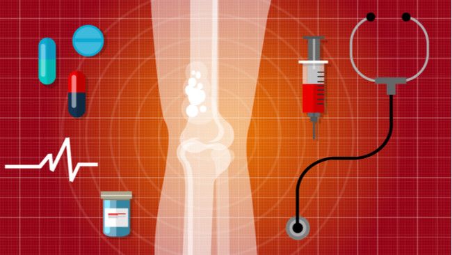 Kelebihan Konsumsi Vitamin D Picu Kanker Tulang?