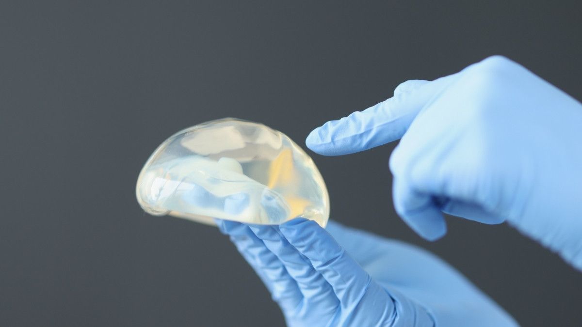 Implan dan Filler Payudara, Mana Lebih Berbahaya?