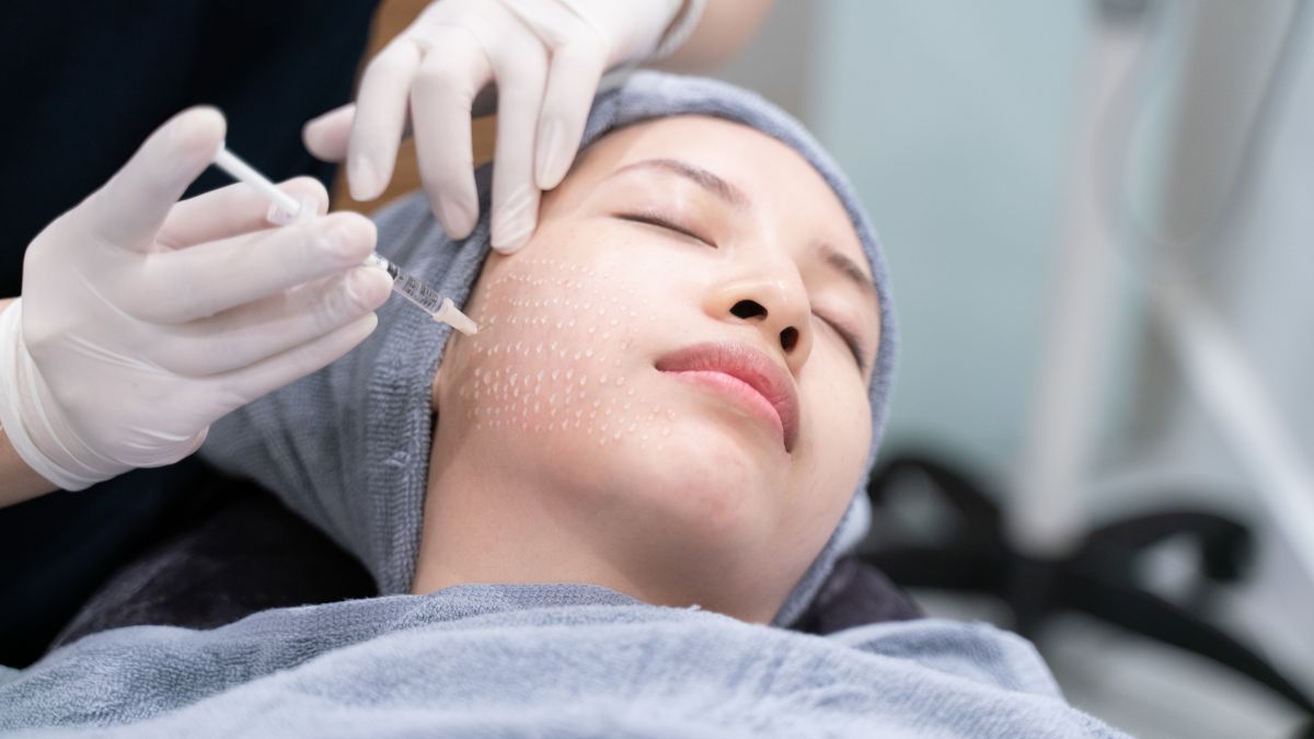 Mesotherapy: Manfaat, Prosedur, dan Efek Samping