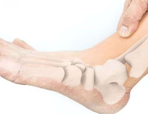 Cara Menyembuhkan Kaki X yang Bisa Anda Coba di Rumah