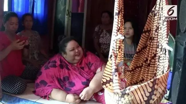 Kenali Obesitas Morbid seperti Dialami Titi Wati si Wanita 350 kg