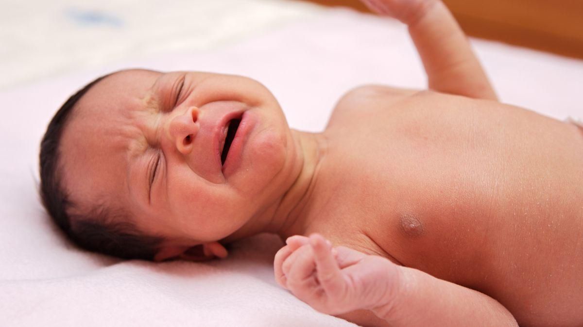 Kenali 5 Ciri-Ciri Anak Mengalami Penyakit Marasmus