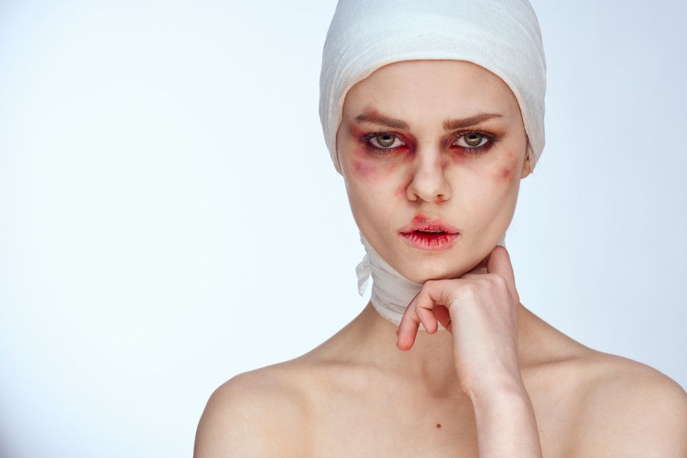 Perbedaan Bengkak Akibat Operasi Plastik dan Penganiayaan