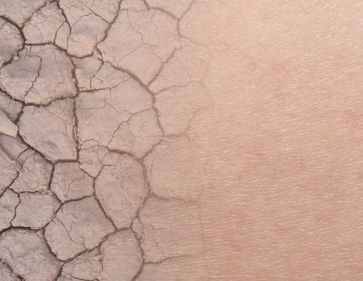 9 Kiat Atasi Kulit Wajah Kering dan Kasar Saat Ibadah Haji