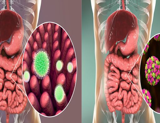 Perbedaan Norovirus dan Rotavirus Si Penyebab Diare!
