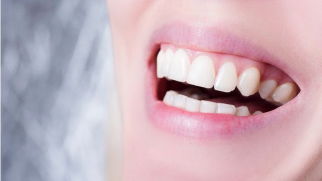 Daftar Perawatan Gigi yang Ditanggung BPJS