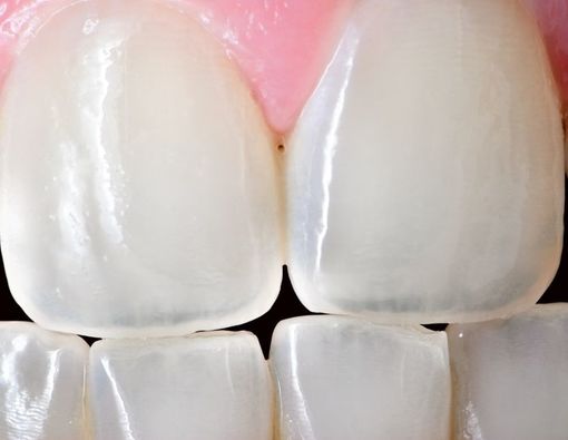 Apa Sebenarnya Fungsi Gigi Seri? Ini Faktanya