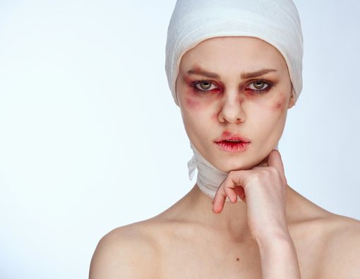 Perbedaan Bengkak Akibat Operasi Plastik dan Penganiayaan