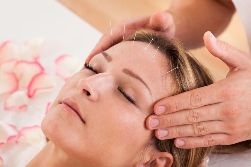 Cegah Penuaan Dini dengan Terapi Akupunktur