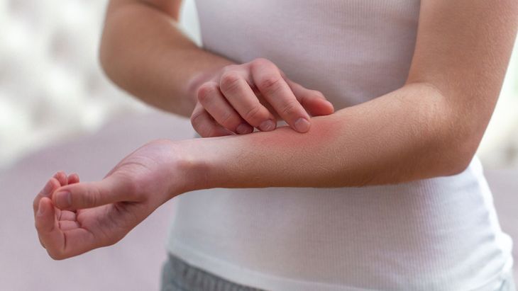 7 Hal yang Tak Boleh Dilakukan Pemilik Kulit Sensitif (Goffkein.pro/Shutterstock)