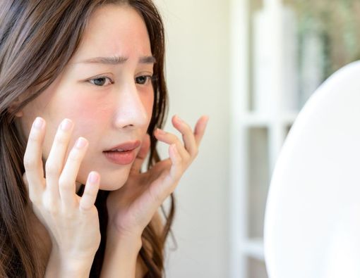 Punya Kulit Sensitif? Jangan Keliru, Ini Cara Memilih Skincare yang Tepat untuk Kamu