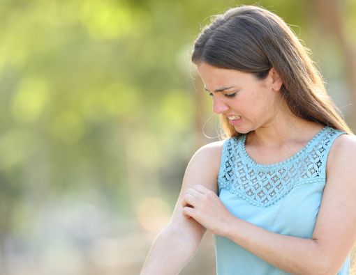 4 Alergi Kulit pada Wanita yang Perlu Anda Tahu