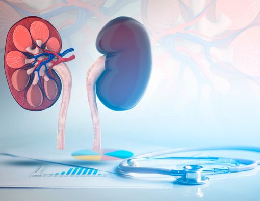 Batu Ginjal Bisa Berakhir Gagal Ginjal, Benarkah?