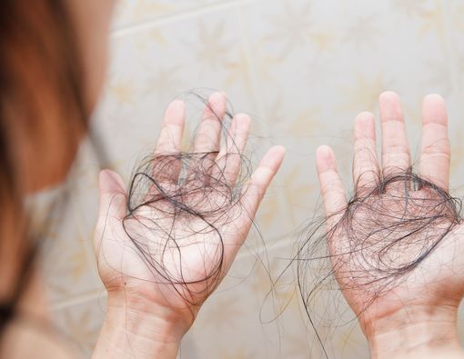 Rambut Menipis, Atasi dengan Cara Ini