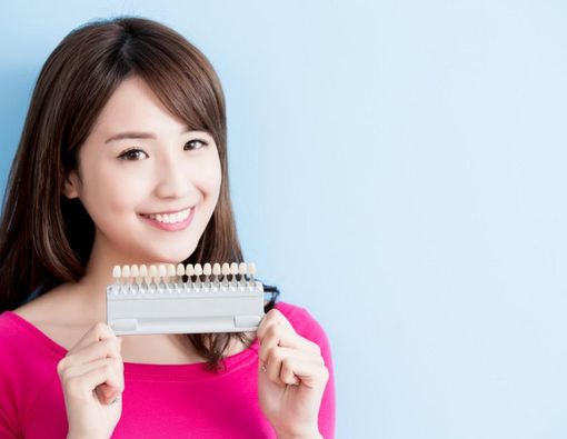 Ketahui Manfaat Veneer Gigi, Tak Cuma Bikin Putih!