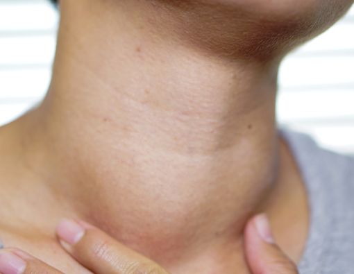 Catat! Ini Gejala Hipertiroid yang Mudah Dikenali