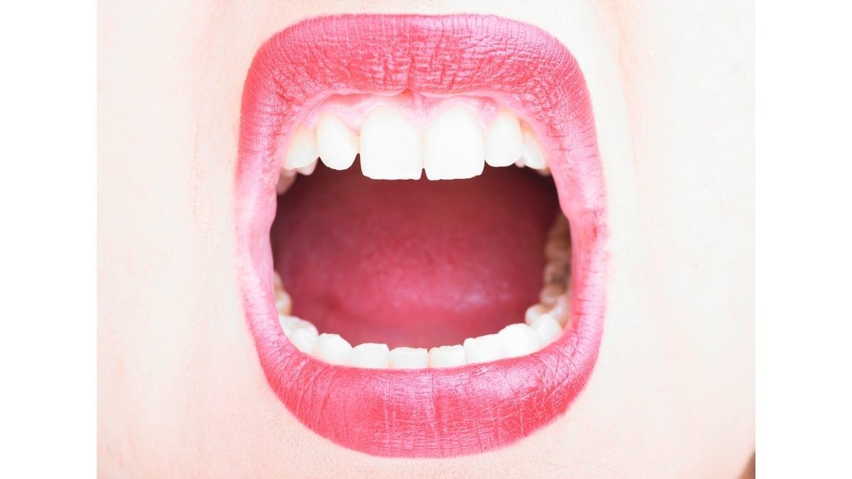 Cara Mengobati Luka di Mulut Bagian Dalam