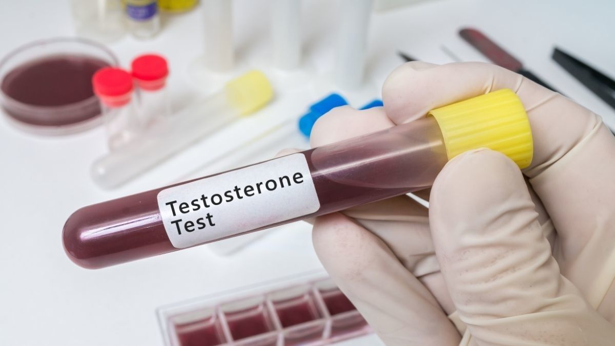 Apa Jadinya Jika Wanita Tidak Punya Hormon Testosteron?
