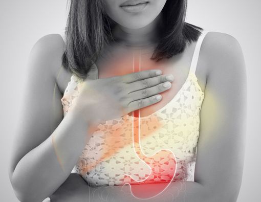 Lansoprazole atau Esomeprazole, Mana Paling Ampuh Atasi GERD?