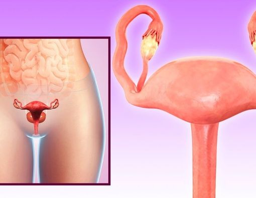 Metode dan Manfaat Prosedur Peremajaan Vagina