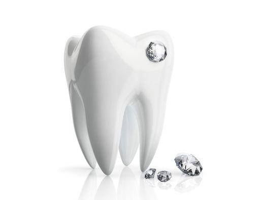 Serba-Serbi Pasang Diamond Gigi