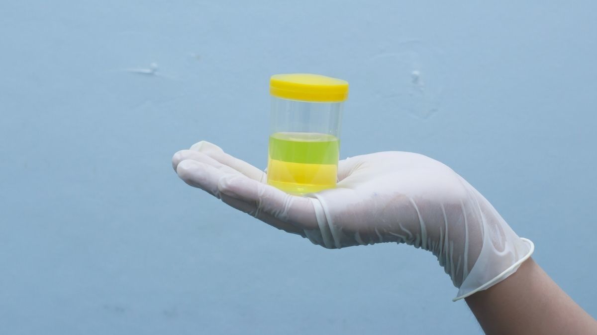 Mengenal Tes Noninvasif untuk Mendeteksi Sel Kanker