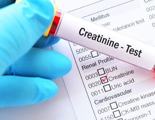 Tips Menurunkan Kadar Kreatinin dalam Tubuh
