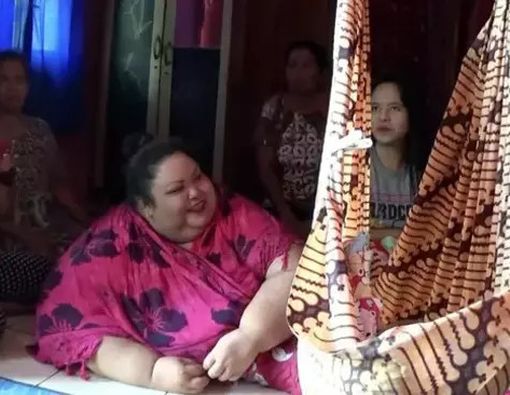 Kenali Obesitas Morbid seperti Dialami Titi Wati si Wanita 350 kg