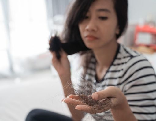 Beragam Faktor Risiko Alopecia Areata