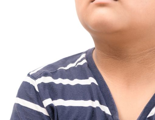 Akantosis Nigrikans, Kelainan Kulit yang Jarang Disadari