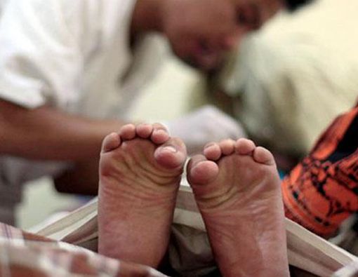 Panduan Memilih Metode Sunat, Mana yang Paling Baik?