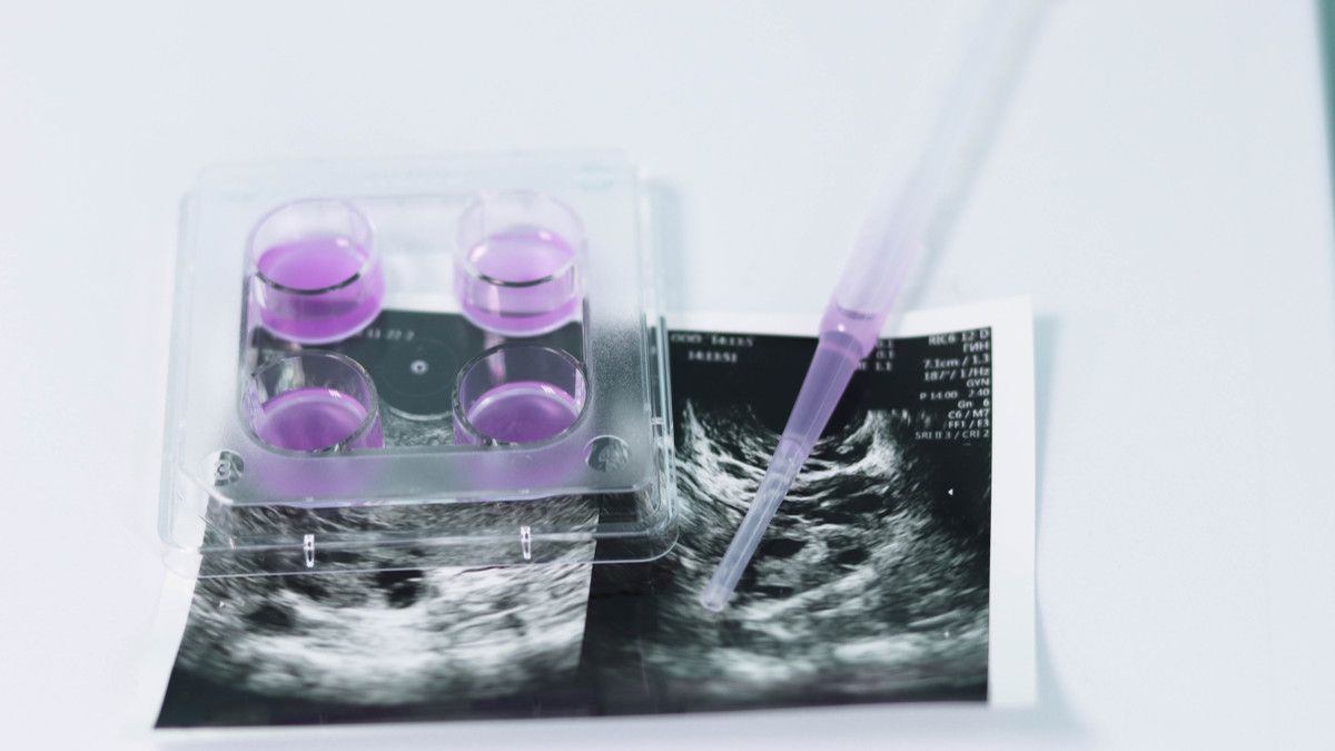 Penyebab Program Bayi Tabung Gagal