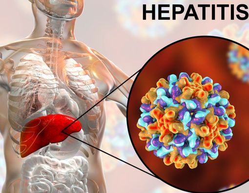 Bisakah Penyakit Hepatitis B Disembuhkan?
