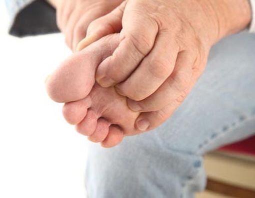 Jangan Garuk Daerah yang Terkena Infeksi Jamur