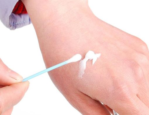 Jangan Sembarangan Mengobati Infeksi Jamur!