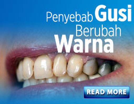 Penyebab Gusi  Berubah Warna