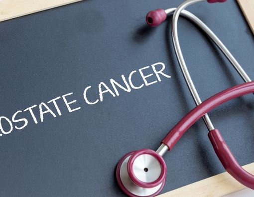 Bisakah Wanita Mengalami Kanker Prostat?