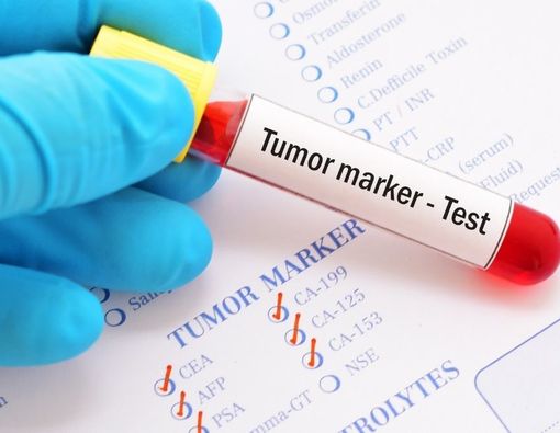 Mengenal Tumor Marker sebagai Metode Deteksi Kanker
