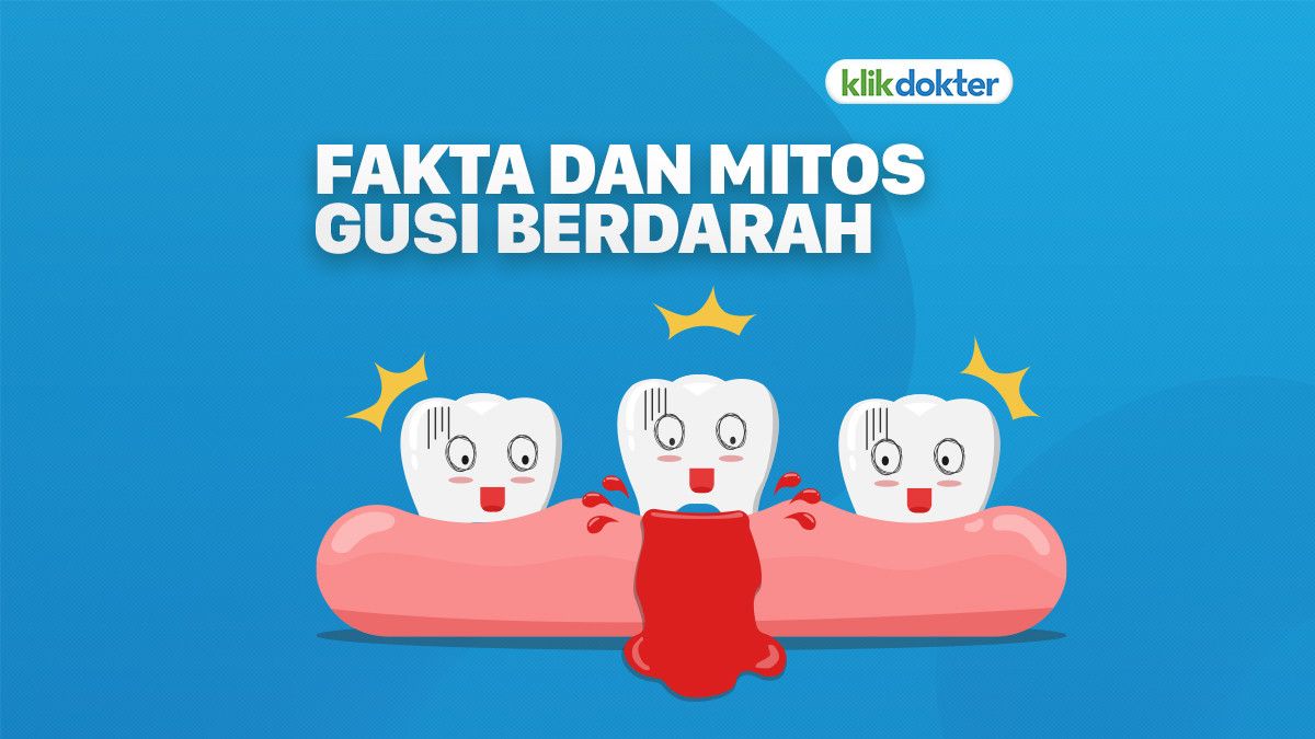 Kenali Fakta dan Mitos Gusi Berdarah