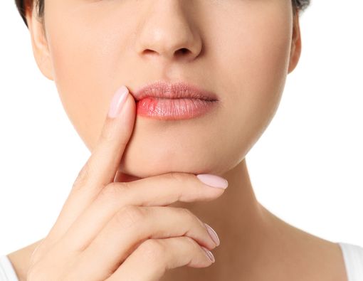 Penyakit yang Ditandai Luka pada Bibir