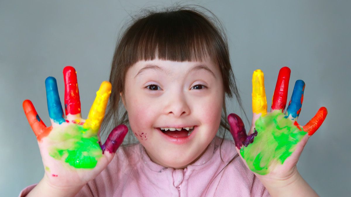 Anak Down Syndrome