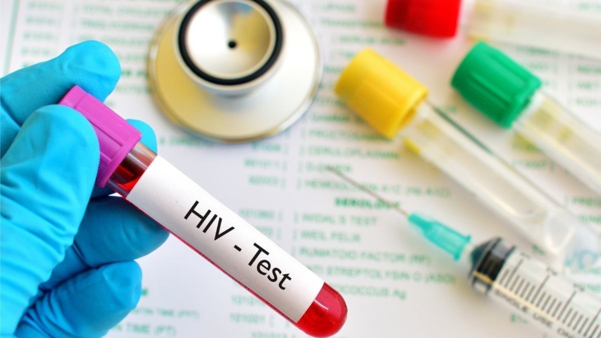Peneliti Temukan HIV Jenis Baru, Dinilai Lebih Infeksius
