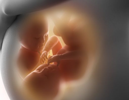 Risiko yang Mungkin Dialami Ibu Hamil Kembar