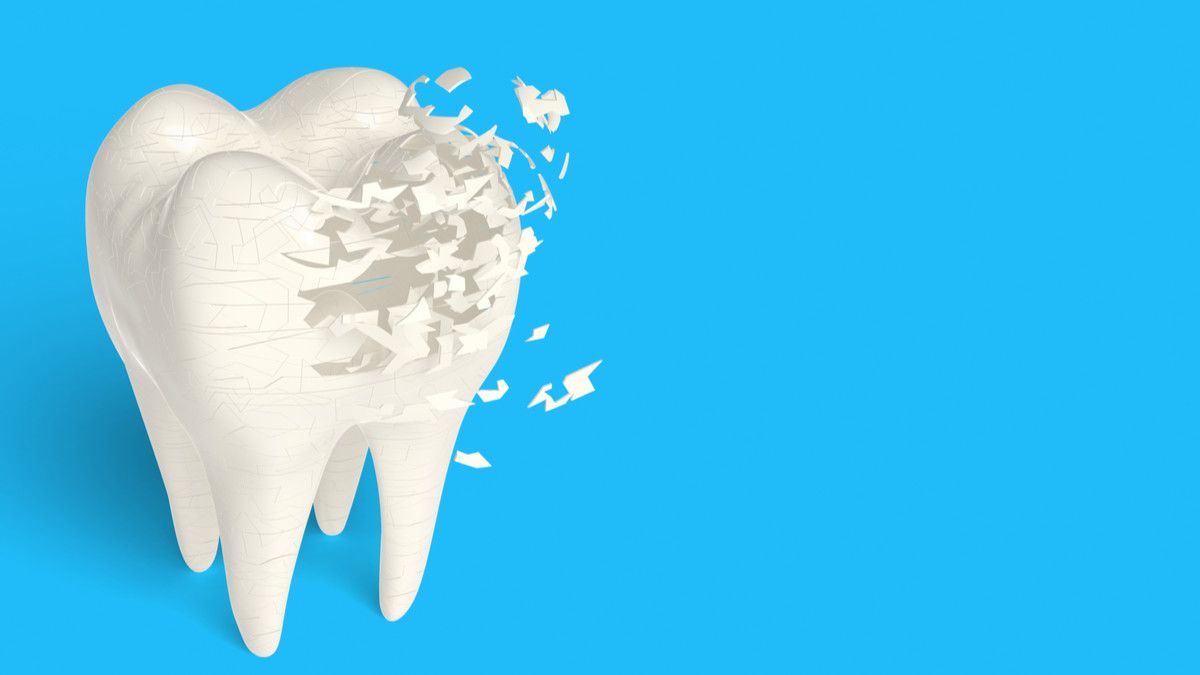 Ilustrasi Gigi Keropos