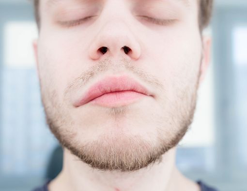 Mengapa Stroke Bisa Bikin Orang Pelo?