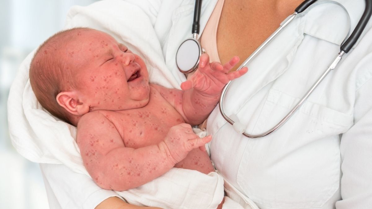 Kenali Hepatoblastoma, Kanker Hati yang Bisa Menyerang Bayi