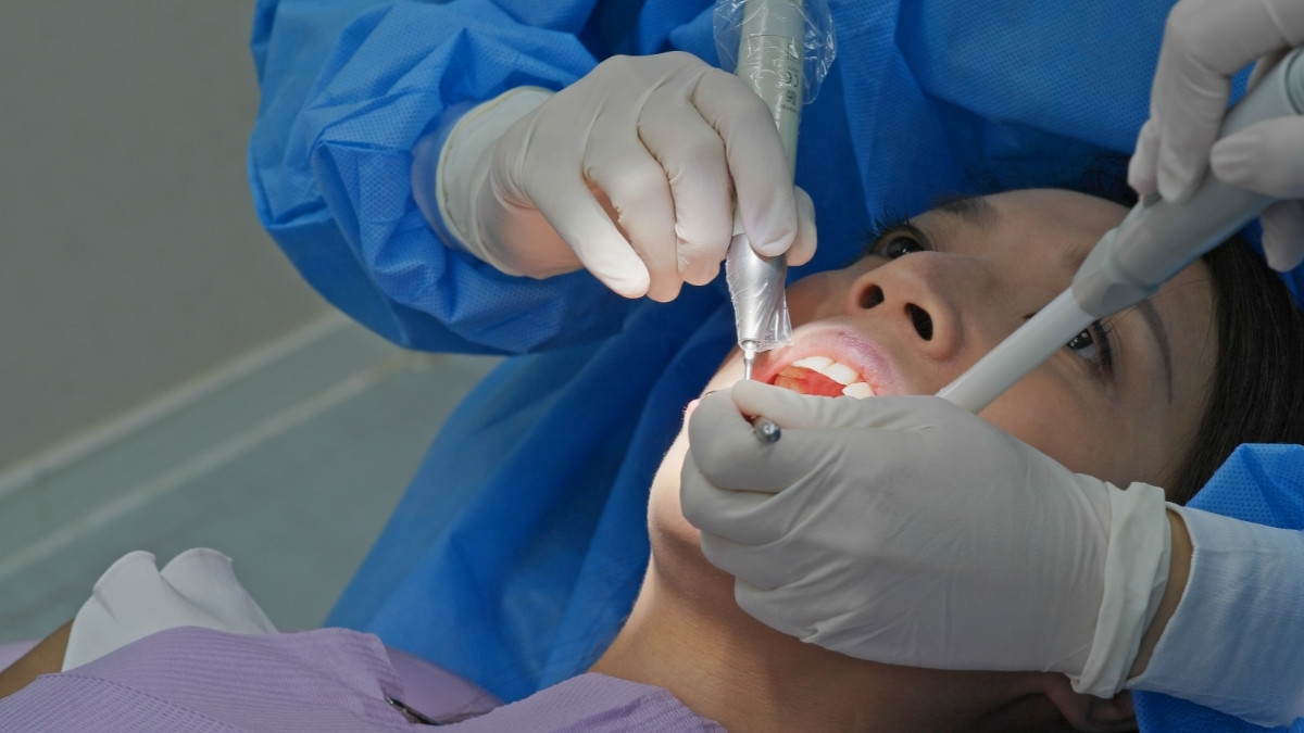 Bolehkah Sikat Gigi Setelah Melakukan Scaling