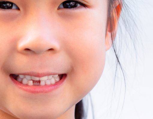 Kapan Gigi Anak Mulai Tanggal? Ini Penjelasan Dokter Gigi