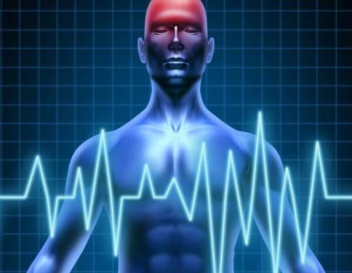 Kolesterol Tinggi = Stroke