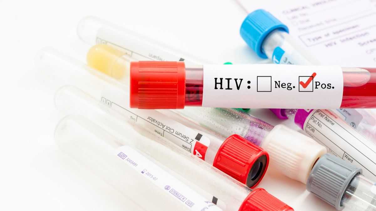 Jenisjenis Tes HIV yang Wajib Anda Tahu KlikDokter